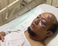 Novel Baswedan Disiram Air Keras, Diduga Terkait Kasus E-KTP