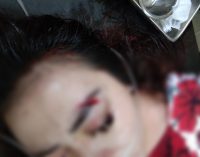 Tak  Sanggup Bayar Usai Kencan, Warga Karawang Nyaris Tewas Ditusuk