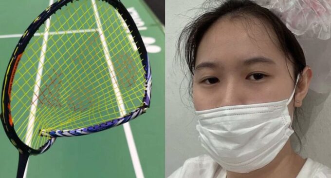 Atlet Tiongkok Tak Sengaja “Smash” Kepala Partner