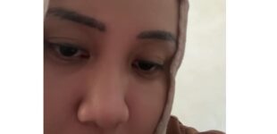 Imbas Komentar Tak Empati ke Pasien BPJS, RS Pusri Hentikan Kerja Sama dengan dr. Tamara